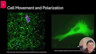The role of LINC complex and nuclear polarization in migrating fibroblasts